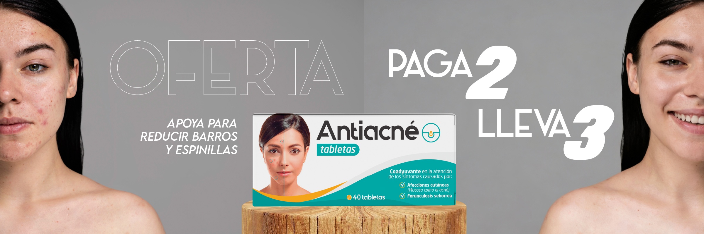 Remedio natural para el acne